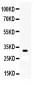 Anti-Otx2 Picoband Antibody