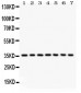 Anti-PP2A-Alpha Picoband Antibody