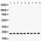 Anti-Peroxiredoxin 1 Picoband Antibody