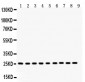 Anti-Peroxiredoxin 3 Picoband Antibody