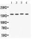 Anti-Patched/PTCH1 Picoband Antibody