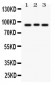 Anti-Semaphorin 3A Picoband Antibody