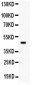 Anti-SerpinB2 Picoband Antibody