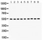 Anti-Vimentin Picoband Antibody