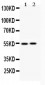 Anti-Vimentin Picoband Antibody