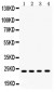 Anti-RBP4 Picoband Antibody