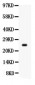 Anti-Prolactin Picoband Antibody