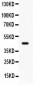 Anti-ADRB2 Picoband Antibody