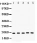 Anti-Caspase-2 Picoband Antibody