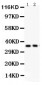 Anti-FRZB Picoband Antibody