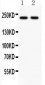 Anti-NMDAR2B Picoband Antibody