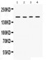 Anti-HKDC1 Picoband Antibody