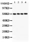 Anti-PKM2 Picoband Antibody