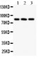 Anti-Calcineurin A Picoband Antibody