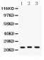 Anti-Peroxiredoxin 5 Picoband Antibody