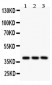 Anti-PTGER2 Picoband Antibody