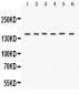 Anti-ROCK2 Picoband Antibody