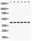 Anti-L-Selectin Antibody