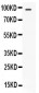 Anti-STAT6 Picoband Antibody