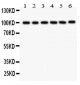Anti-STIM1 Picoband Antibody