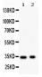 Anti-Synaptophysin Picoband Antibody