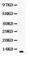 Anti-Resistin Picoband Antibody