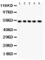 Anti-ABI1 Picoband Antibody