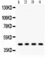 Anti-ADIPOR1 Picoband Antibody