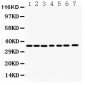 Anti-Annexin A3 Picoband Antibody