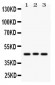 Anti-Ataxin 3 Picoband Antibody