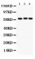 Anti-Heparanase 1 Picoband Antibody