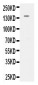 Anti-VEGFR2/KDR Antibody