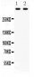 Anti-Plectin Picoband Antibody