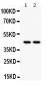 Anti-RUNX3 Picoband Antibody