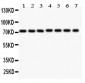 Anti-SDHA Picoband Antibody