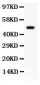 Anti-SGK1 Picoband Antibody