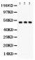 Anti-SLC2A2 Picoband Antibody