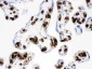 Anti-Band 3 Picoband Antibody