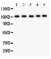 Anti-Band 3 Picoband Antibody