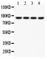 Anti-SLC6A4 Picoband Antibody