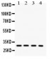 Anti-SNRPN Picoband Antibody