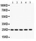 Anti-SOD2 Picoband Antibody