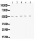 Anti-TACR1 Picoband Antibody