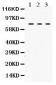 Anti-TGM2 Picoband Antibody