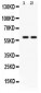 Anti-Tyrosine Hydroxylase Picoband Antibody