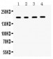 Anti-THBS1/TSP1 Antibody