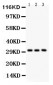 Anti-VDAC/Porin Picoband Antibody