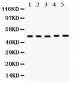 Anti-VDR Picoband Antibody