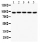 Anti-Villin Picoband Antibody