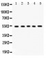 Anti-Vitronectin Picoband Antibody